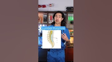 What happens if you get a spinal tap (lumbar puncture)