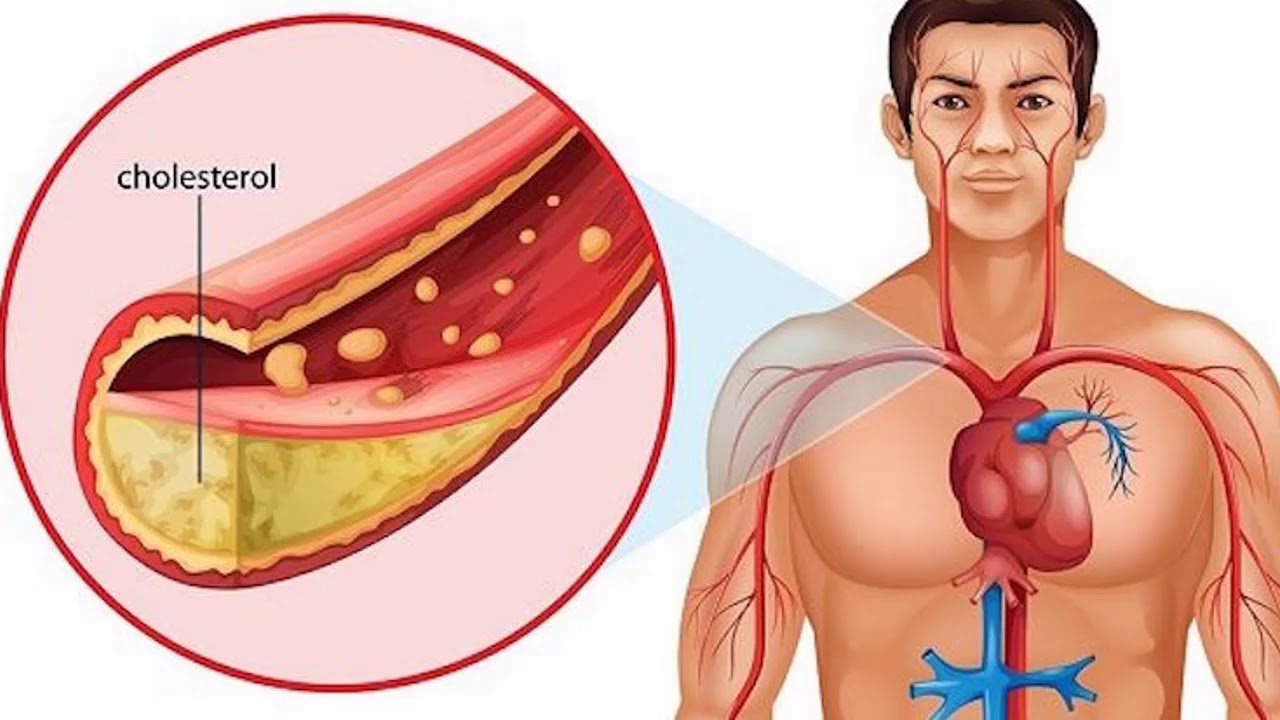 The Most Effective Natural Remedy Against High Blood Pressure And