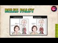 Bells Palcy Explanation | Facial Muscles | Head &amp; Neck | Anatomy | Medico
