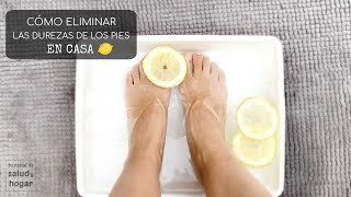 Cómo eliminar las durezas de los pies en casa