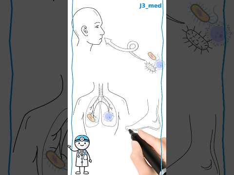 جدتي  الطب الطب طبيب الجزائر اكسبلور السعودية ترند العراق  المغرب  طبيب