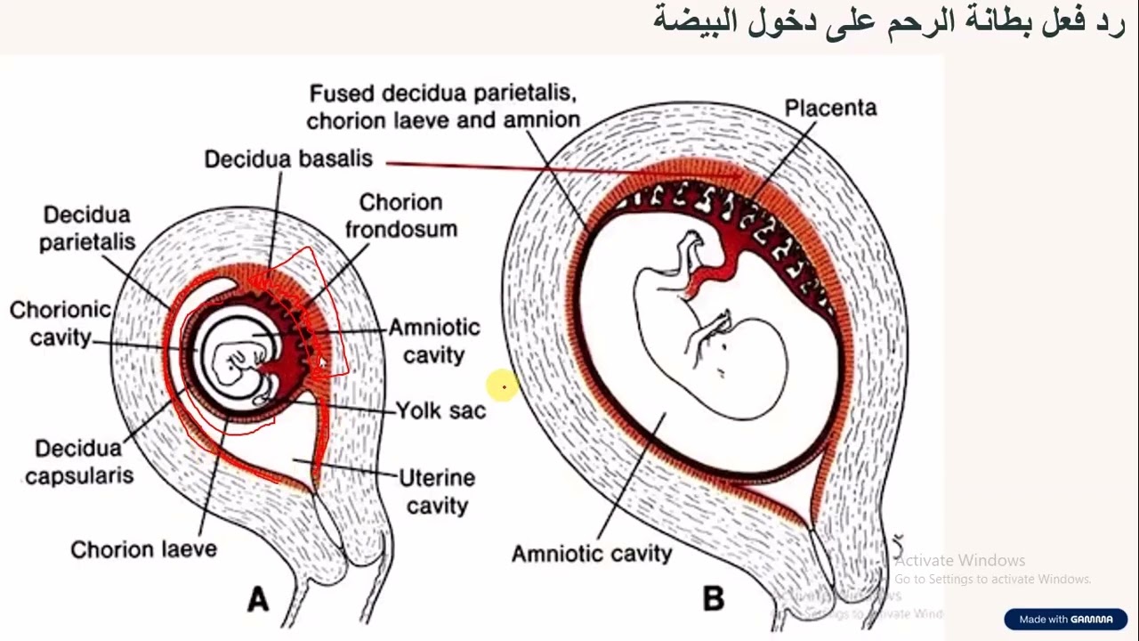 التفاعل الساقطي + شذوذ  الانغراس