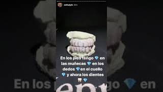 El Alfa  *El Animal* Sus Nuevos Dientes 😬💎💎🤯🚀