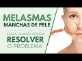 MELASMAS e manchas de pele? Essas plantas podem RESOLVER ISSO!