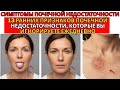 13 ранних признаков почечной недостаточности (которые вы игнорируете ежедневно) | Симптомы почечной