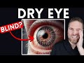 6 ways dry eyes can affect your eyes and vision can you go blind