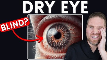 6 manieren waarop droge ogen je ogen en zicht kunnen beïnvloeden! (Kun je blind worden?)