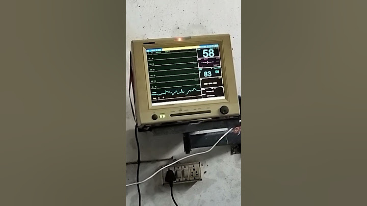 Live Patient Death In Hospital Check Patient moniter
