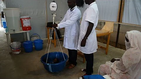 MSF hospital treats severely malnourished children in Chad