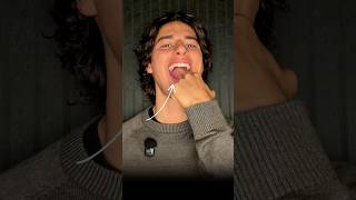You Don’t Have A Double Chin, You Just Have A Tongue Tie