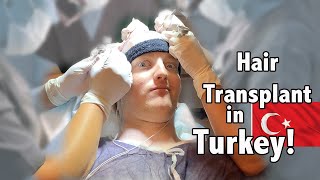 I got a Hair Transplant in TURKEY!