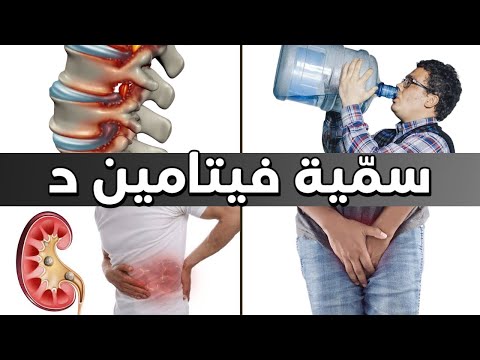 العلامة الأولى التي تدل على زيادة فيتامين د أكثر من اللازم في الجسم