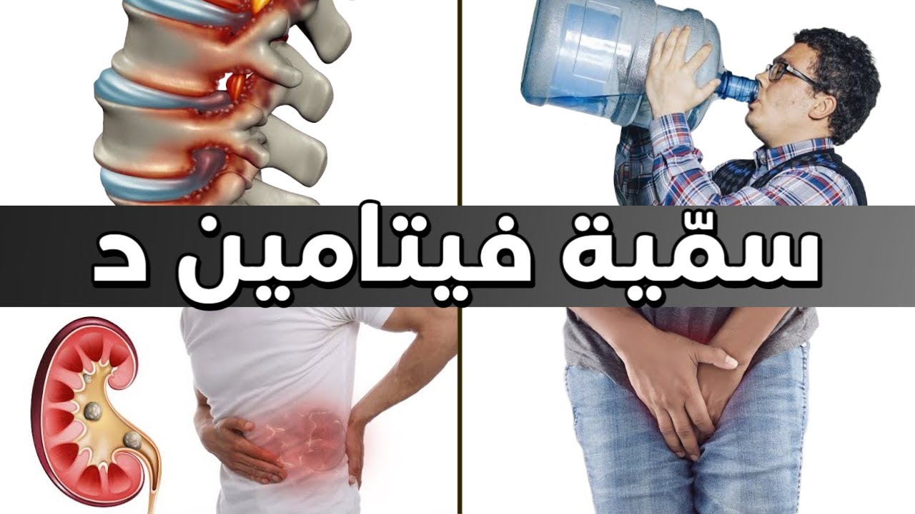 العلامة الأولى التي تدل على زيادة فيتامين د أكثر من اللازم في الجسم