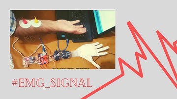 EMG Based Prosthetic Hand For Amputees | Liono Maker Official