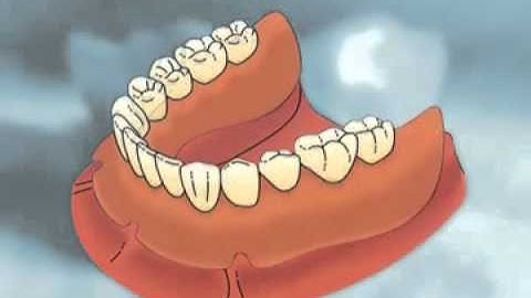 Animation About Dentures