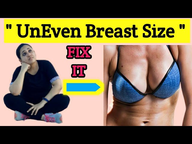 UNEVEN BREAST FIX ( 100%), Reduce Breast Size, Chest Workout, Sagging  Breast