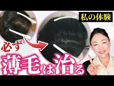 【完全解説】絶対に知っておくべき!女性の4つの薄毛・抜け毛予防策