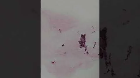 Como tirar mancha maquiagem da parede?