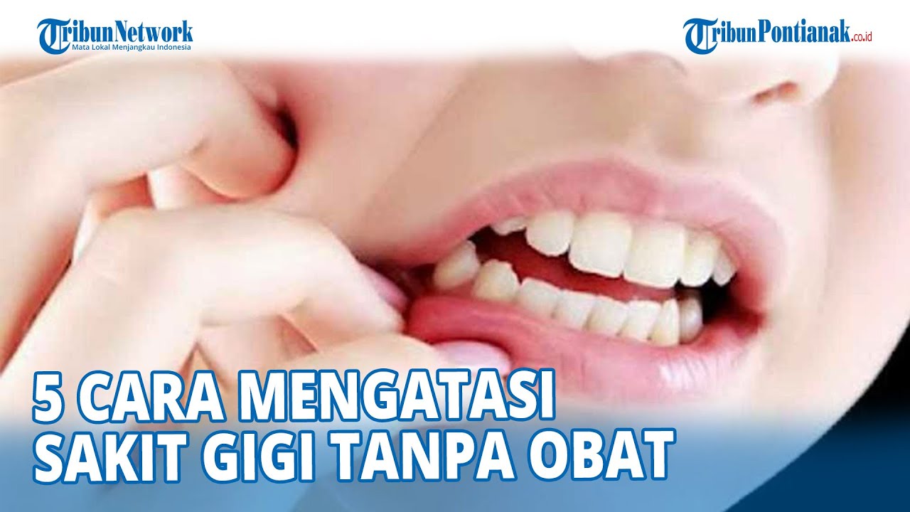 5 Cara Mengatasi Sakit Gigi Tanpa Obat - YouTube