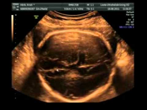 Video: Kuidas Laps Ultrahelis Välja Näeb