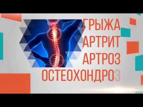 Медицинский центр суставы ортит коленного сустава