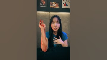 손바닥 피 결과