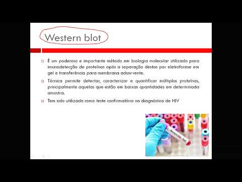 Western blotting