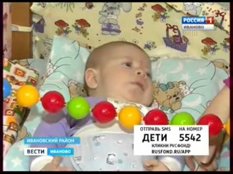 Саша Бартенев, 4 месяца, синдром Беквита – Видемана, требуется операция