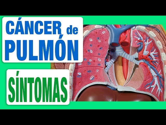 dolor de garganta flemas con sangre dolor de garganta flemas con sangre
