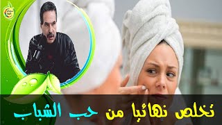 اصنعي كريمات طبيعية للتخلص من حب الشباب نهائيا  -  الدكتور جمال الصقلي  -