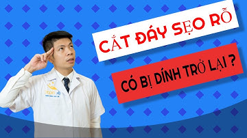 Cắt đáy SẸO RỖ có bị dính lại không- Vết thương trên mặt trị thâm ra sao/Hỏi Dr Ngọc #5
