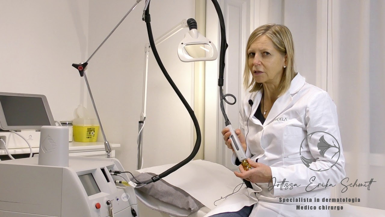 Come funziona l'epilazione Laser ad Alessandrite?