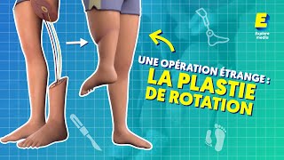 La Plastie de rotation : une opération étrange mais pratique ! ???? #shorts