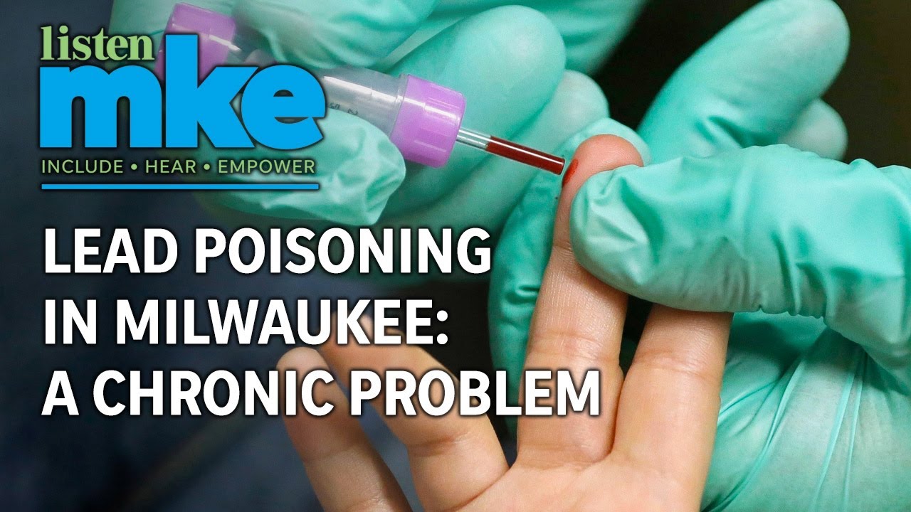 Lead poisoning in Milwaukee a chronic problem YouTube