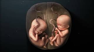 Twins pregnancy week by week  जुड़वा बच्चे क्यों होते हैं