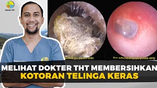 Download Lagu Melihat Dokter Tht Membersihkan Kotoran Telinga Keras | Dokter Tht MP3 Download Lagu Melihat Dokter Tht Membersihkan Kotoran Telinga Keras | Dokter Tht MP3