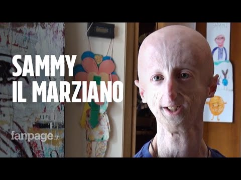 Video: Hai Trovato Una Cura Per La Progeria? - Visualizzazione Alternativa