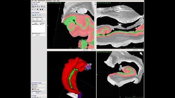 Manual hippocampal segmentation (x4 speed) in ex-vivo MRI