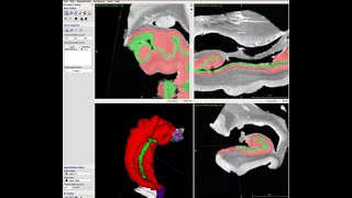 Manual hippocampal segmentation (x4 speed) in ex-vivo MRI