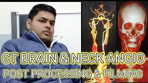 CT BRAIN AND NECK ANGIO POST PROCESSING AND FILMING