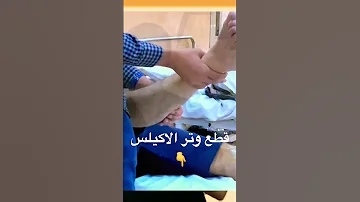 قطع وتر الاكيلس 