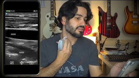 GE Vscan NeckAnatomy demo