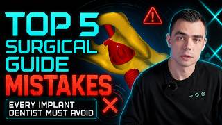 Top 5 Surgical Guide Mistakes That Can Ruin Your Implant Case