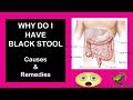 Enlarging Stomach And Dark Stools