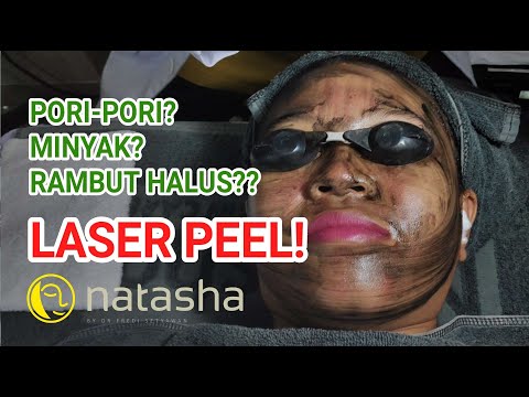 Microdermabrasi Atau Diamond Peel Natasha Skincare || dr.Nata Natasha Mataram. 