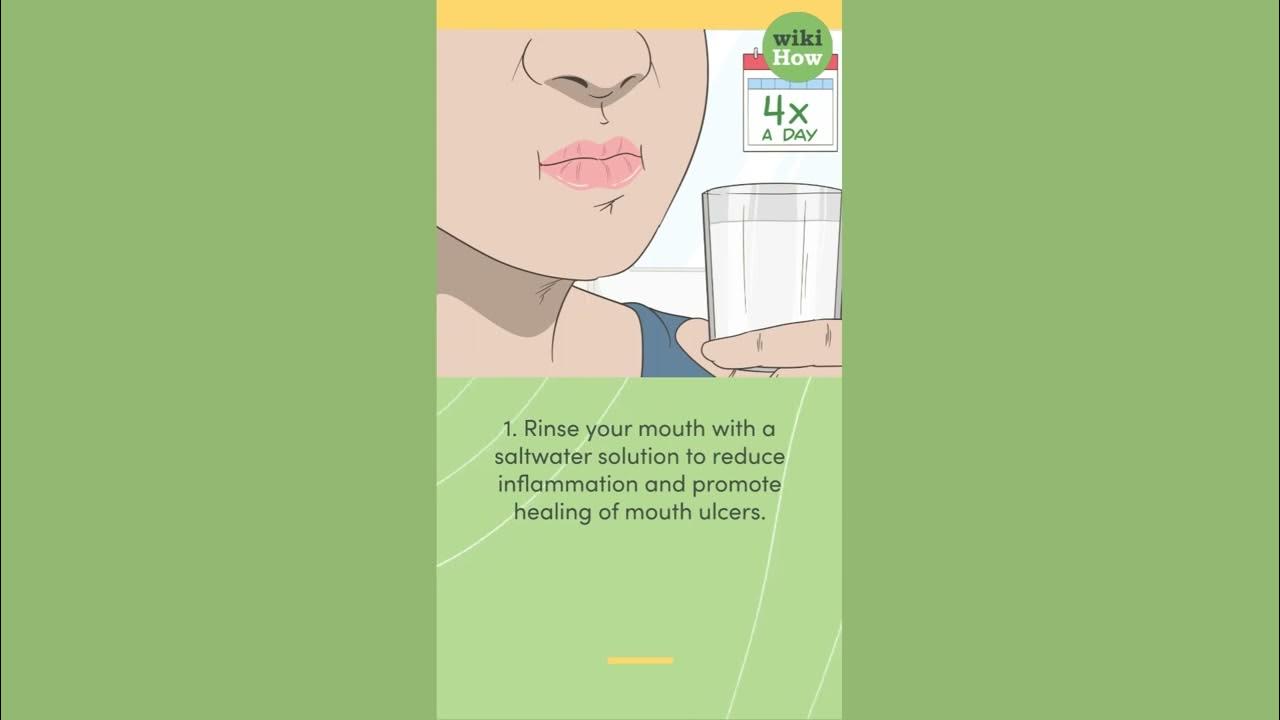 How To Cure Mouth Ulcers Fast Naturally YouTube how-to-cure-mouth-ulcers-fast-naturally-youtube