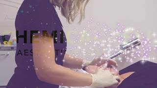 Chemical Peel At Aesthetic Enhancements