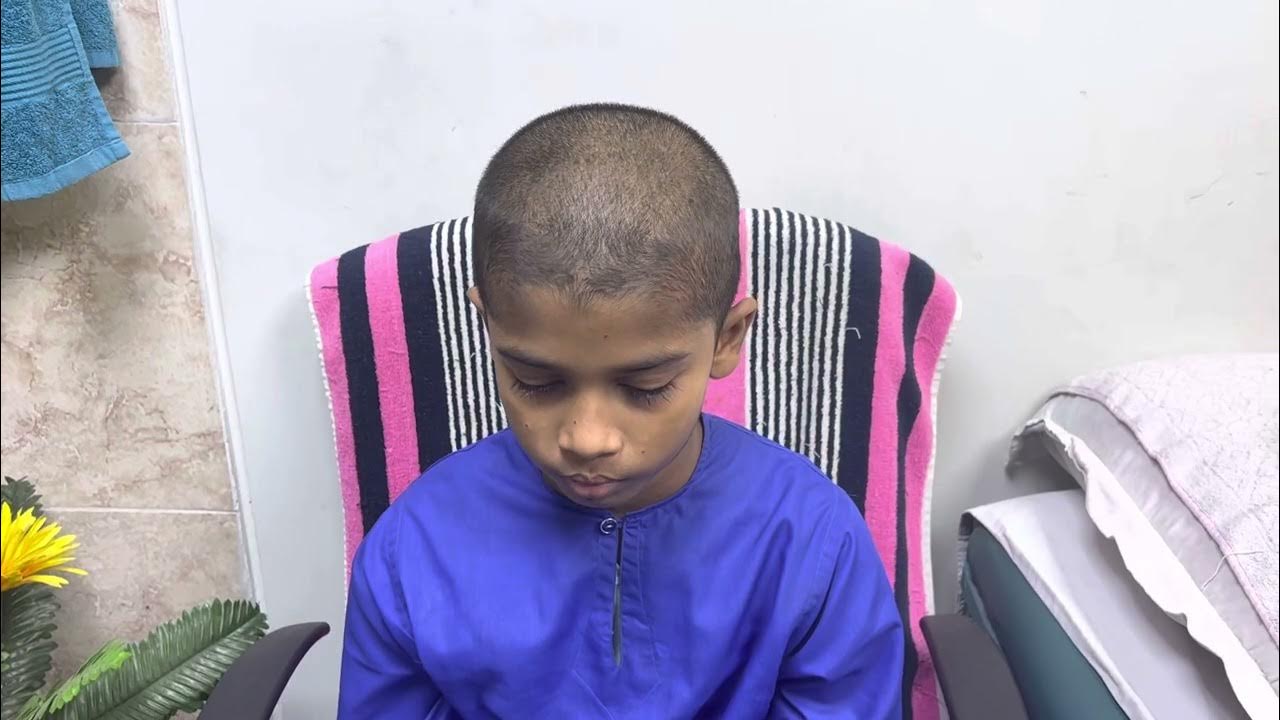 Coin shaped Headache(Numular Headache) YouTube