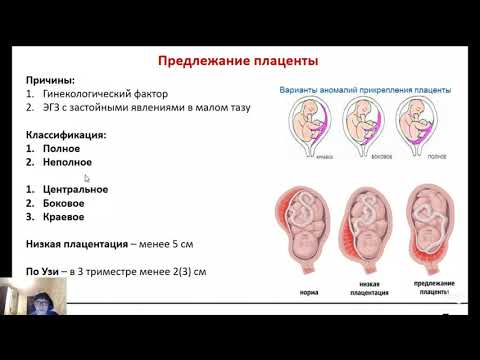 Лекция "Акушерские кровотечения"