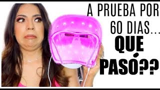 REMEDIO SUPER RARO PARA EL ACNE, FUNCIONA? ♥BeautybyNena